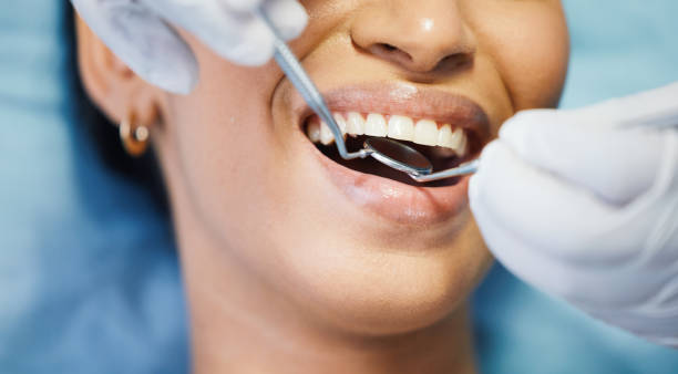 Best Root Canal Emergency Dentist  in Manistique, MI